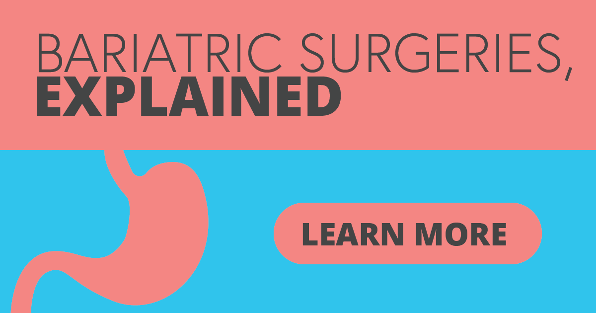 Types of bariatric surgery Arbor Health